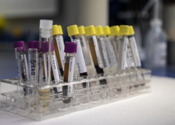 Covid-19 coronavirus