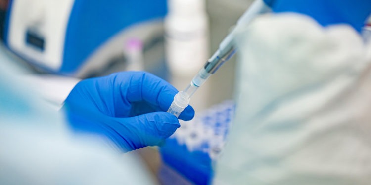 casello covid-19 tampone tappeto test residenziale