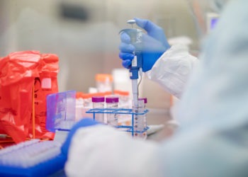 Nuovi positivi covid laboratorio tampone