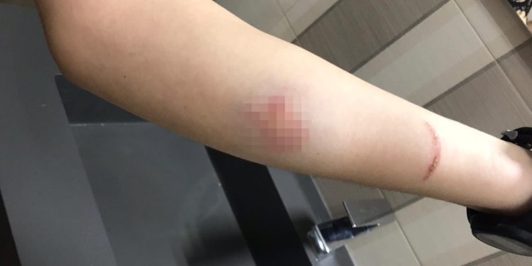 frattamaggiore morde infermiera occorrono