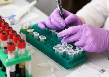 coronavirus ipercovid campania lcovid-19 laboratorio provette