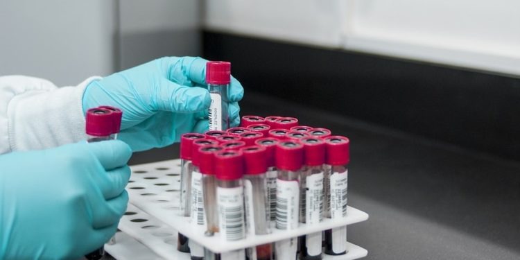 coronavirus test covid