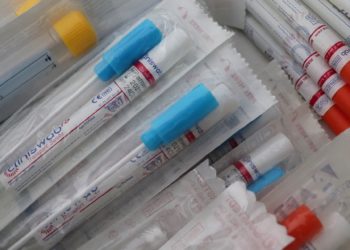Coronavirus, oggi in Campania 188 nuovi positivi su 4.359 tamponi