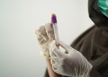 Coronavirus, oggi in Campania 1.718 positivi su 12.530 tamponi