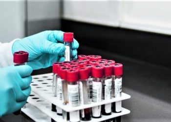 Campania in zona rossa, la decisione attesa per domani