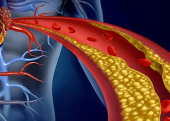 Il colesterolo ha i giorni contati: due farmaci per combatterlo meglio