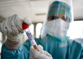 Aggiornamento Covid nel Casertano: 1.893 nuovi casi positivi su 13.597 tamponi processati e 6 decessi