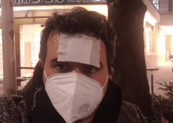 Il prof rimprovera gli alunni: pugni e calci dai genitori sotto casa