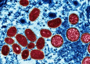 Vaiolo delle scimmie: attivato a Caserta il Checkpoint® per la vaccinazione