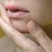 Herpes labiale: un virus «dormiente» risvegliato da sbalzi termici, stress e sole  