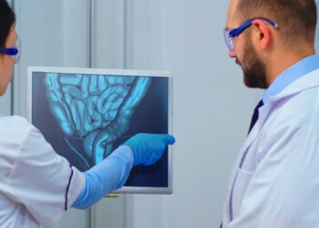 Tumore al colon, casi in aumento: uno studio svela 4 quattro sintomi da non sottovalutare