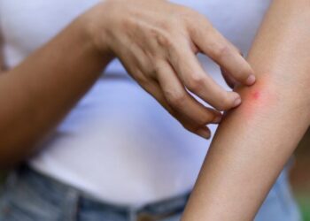 Nuovo repellente contro le punture di zanzara: lo studio