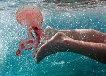 Punture di medusa, una disavventura estiva: cosa fare e cosa evitare